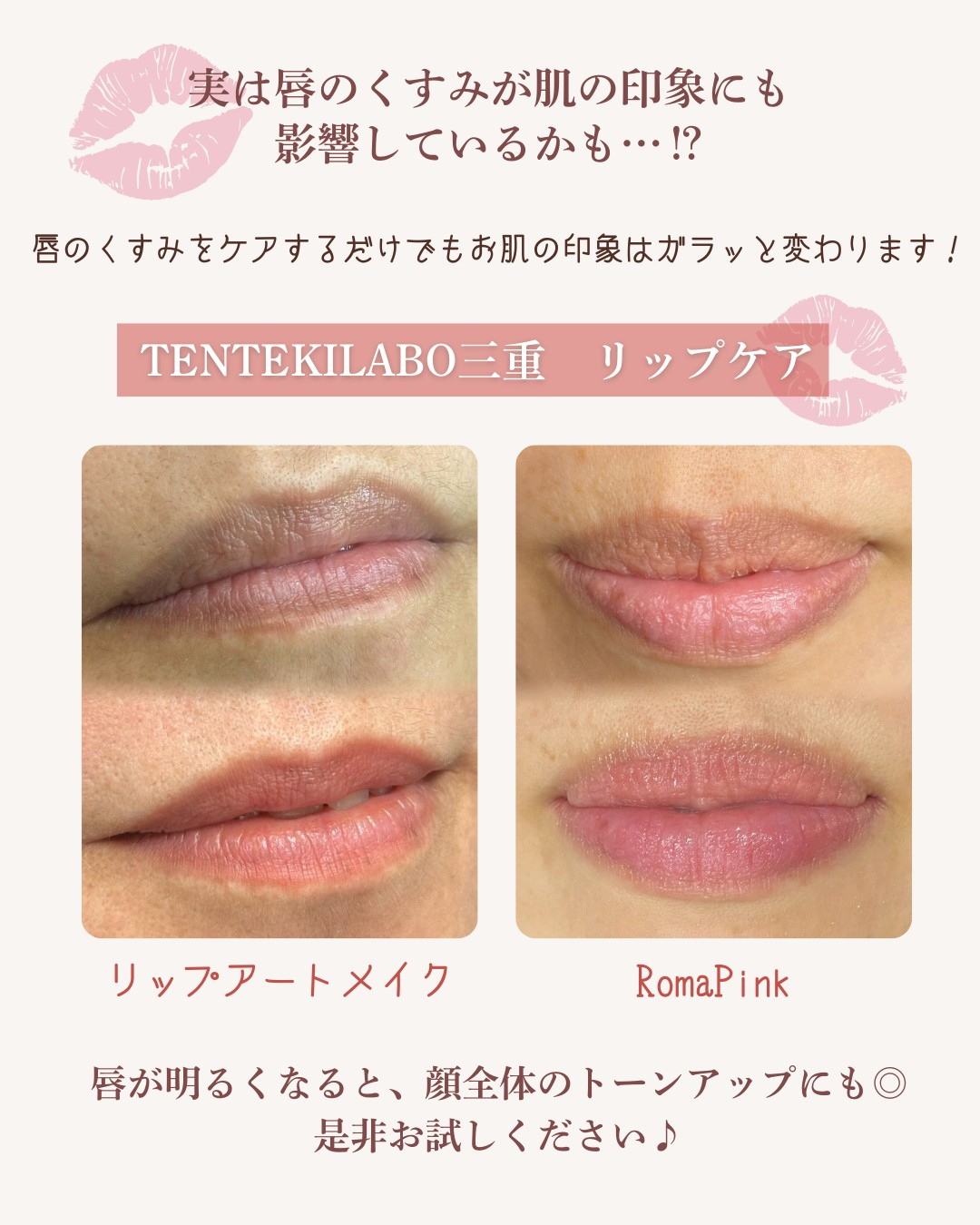 お肌のくすみ改善