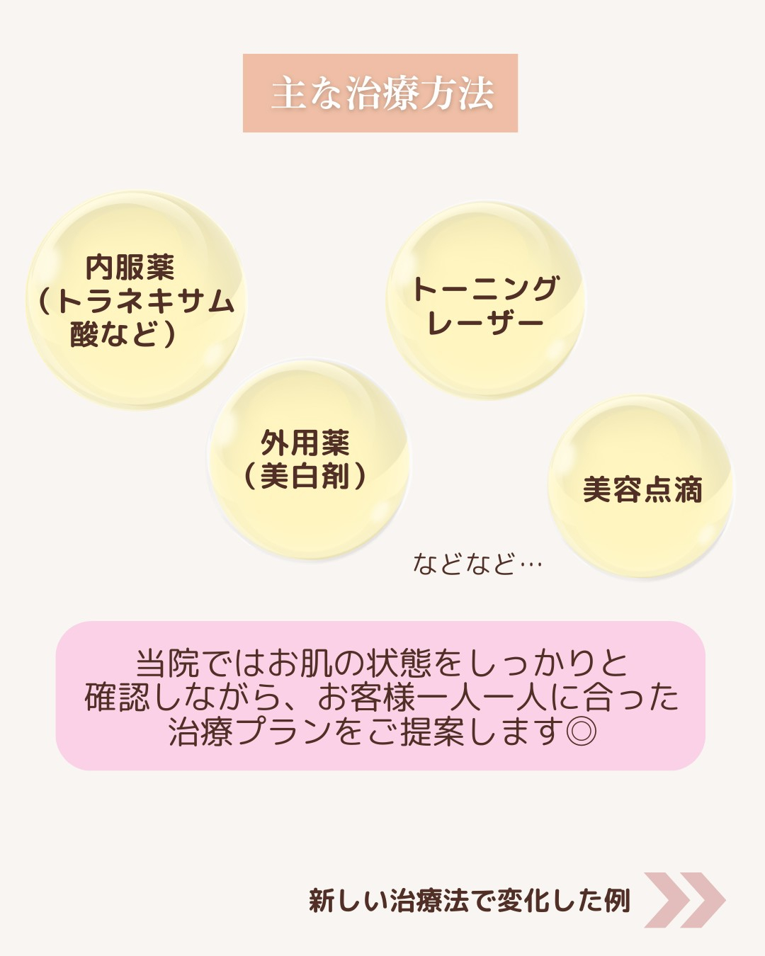 「これって肝斑?」